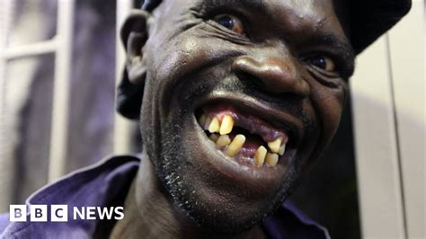 Zimbabwes Mr Ugly Contest Winner Too Handsome Bbc News