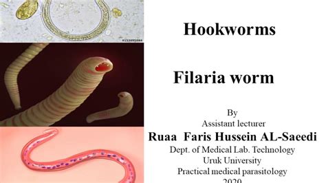 Threadworm And Hookworms And Filaria Worm Youtube