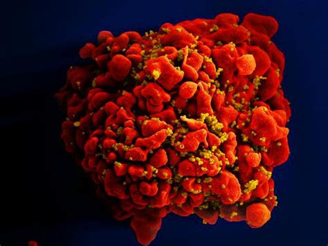 Scientists Discover New Hiv Strain For First Time In Nearly 2 Decades