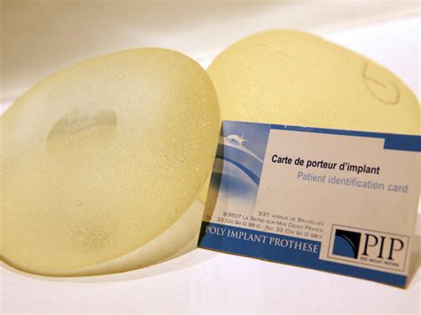Fears Grow Over Faulty French Made Breast Implants Sdpb Radio
