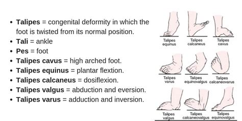 Congenital Talipes Equinovarus Clubfoot Nursing Management Rnpedia