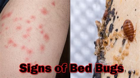 Bedbugs Signs