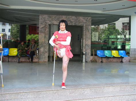 One Legged Woman On Crutches Migliori Pagine Da Colorare