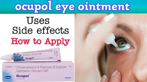 Ocupol Eye Ointment Ocupol Eye Ointment How To Apply Ocupol Eye Ointment Uses In Hindi Youtube
