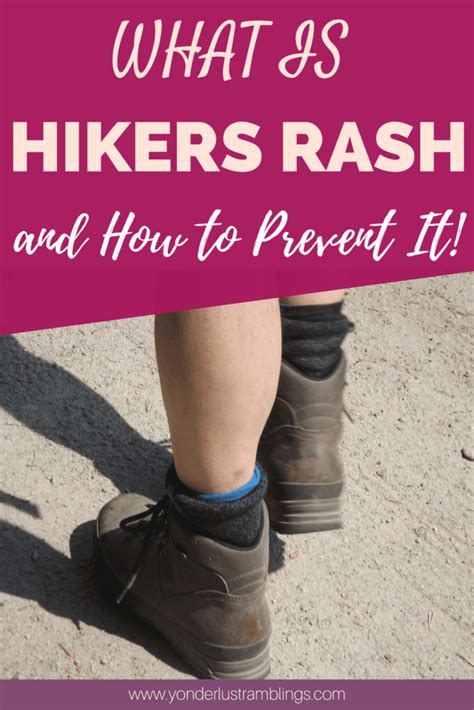 Hikers Rash What Is It And How To Prevent It