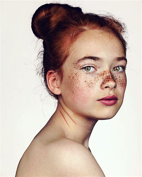 Photographer Takes Portraits Of Freckled People To Celebrate Their Unique Beauty Face