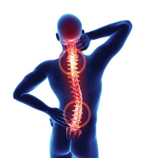 What Are Some Common Causes Of Back And Neck Pain • Sentara Martha