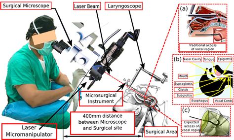 Trans Oral Laser Microsurgery Surgical Dimensional Overview A Download Scientific Diagram