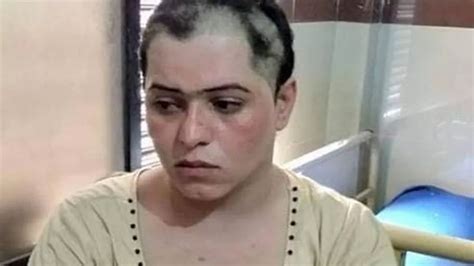 Trans Woman Held Captive And Has Hair Shaved Off By Gang Demanding £5200 World News