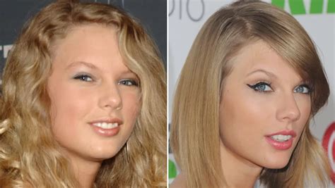 Taylor Swift Plastic Surgery A Closer Look To Undergo Plastic Surgery