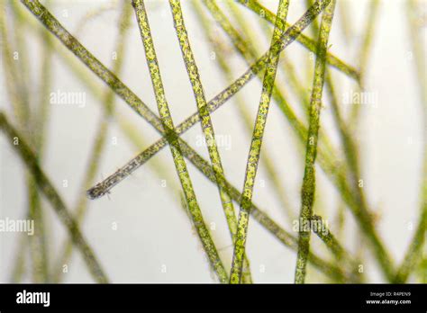 Microscopic Zygnema Algae Detail Stock Photo Alamy