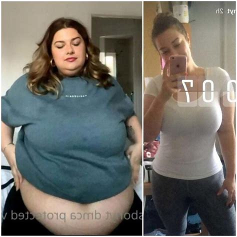 Aliss Bonython S Weight Gain Before And After Reddit NSFW