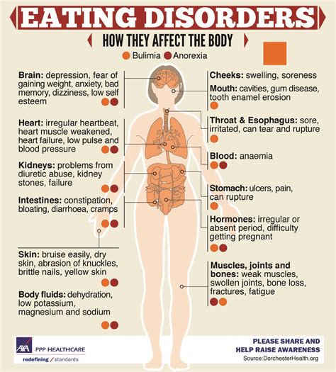 Eating Disorders Don T Just Affect Your Weight They Can Have An Impact On The Whole Body Find