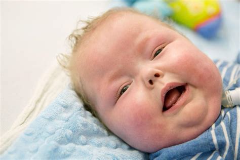 Rare Birth Defect Has Kept Leo In Nicu All His Life But There Is Hope