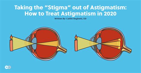 Taking The Stigma Out Of Astigmatism Treating Astigmatism In 2020