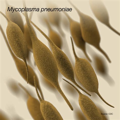Mycoplasma Pneumoniae Infections Storymd