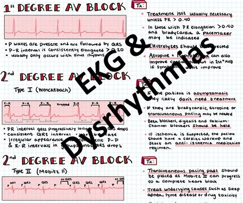 Ekg And Dysrhythmia Interpretation Basics For Nurses And Nursing Etsy