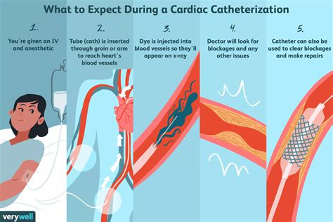 21 Heart Test Catheterization Testheart