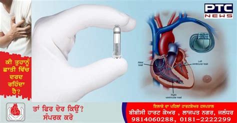 Security and airport personnel are given strict instructions about how to handle people with pacemakers and we warn them never to let a wearer go through a metal detector, an airport spokesperson said. Dos and Don'ts: Life with a Pacemaker