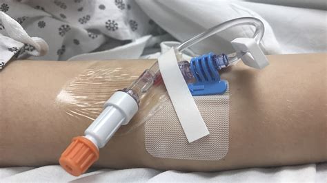 Colocar catéter intravenoso em idosos é um grande desafio Suprevida