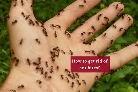 Ant Bites How To Get Rid Of Ant Bites And The Related Discomforts