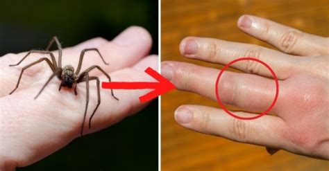 Las arañas más peligrosas del mundo Salud