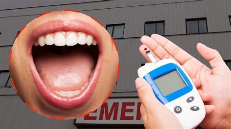 High Blood Sugar Check Your Mouth This Is The First Warning Sign