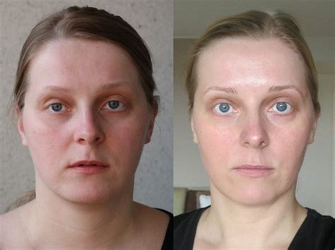 Before And After Facial Exercise Facial Exercises
