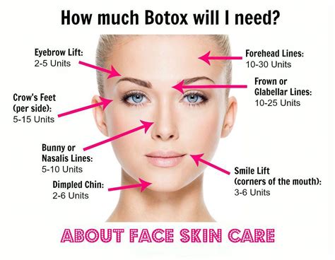 Pin On Botox And Filler