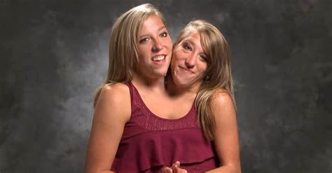 Tlc Conjoined Twins Abby And Brittany Cordey Kissiah