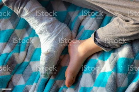 Child With Bandage On Leg Heel Fracture Broken Right Foot Splint Of