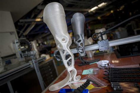 Student Startup ‘limber Makes 3d Printed Prostheses Affordable And