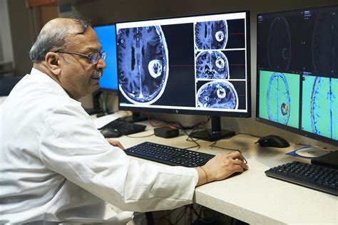 History Of Gamma Knife Radiosurgery At Roswell Park Roswell Park