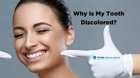 10 Causes Of Tooth Discoloration 2024 Prime Dental Group