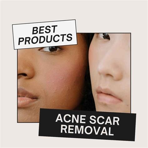 Best Products For Acne Scars Uk 2023 Products For Spotless Skin I