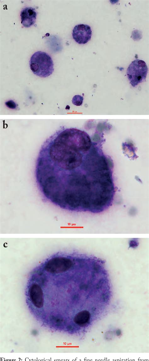 Pdf Apocrine Hidrocystoma In Four Persian Cats Semantic Scholar