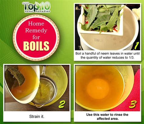 Home Remedies For Boils And Abscesses Top 10 Home Remedies