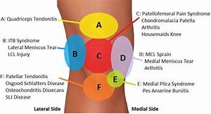 Anterior Knee Diagnosis Chart This Knee Injury Chart Helps
