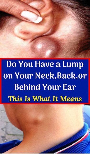 Do You Have A Lump On Your Neckbackor Behind Your Ear