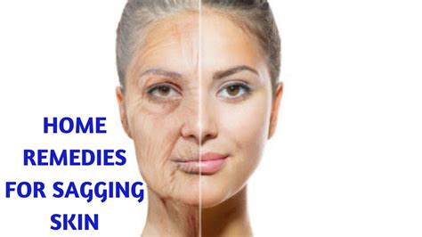 Home Remedies For Sagging Skin Youtube