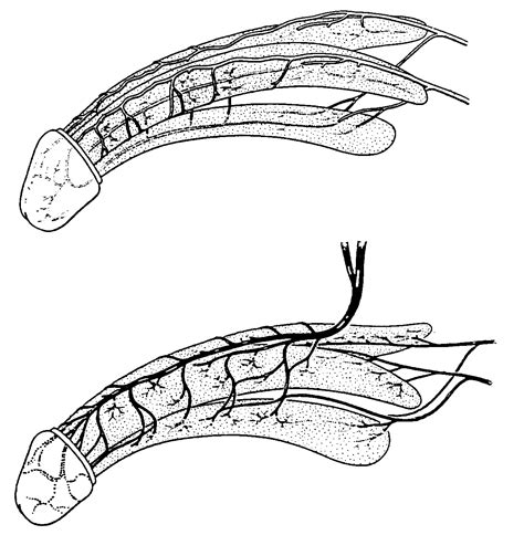 Two Illustrations Of The Penis The Top One Showing The Arteries Of The Penis And The Bottom One
