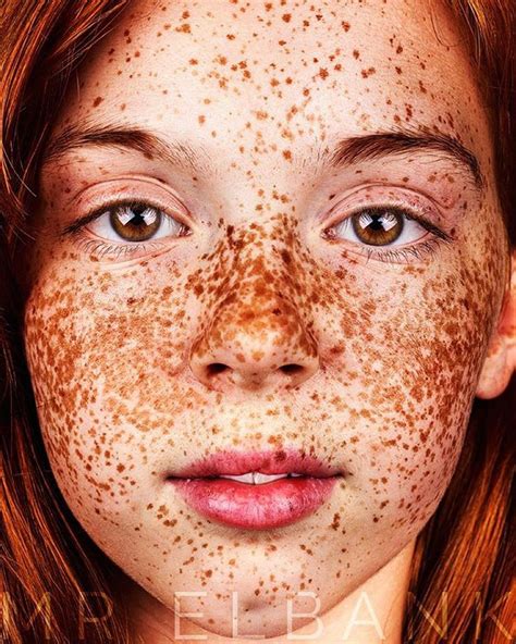 Unique Beauty Of Freckled People Documented By Brock Elbank Freckles Girl Beautiful Freckles