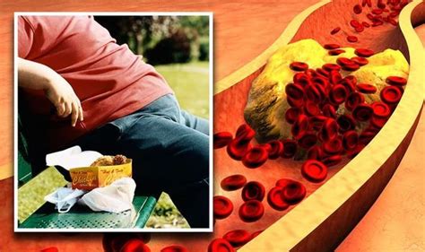 High Cholesterol Warning The Four Biggest Risk Factors For High