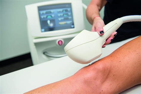 What Is Ipl Hair Removal And Does It Work Tay Medispa