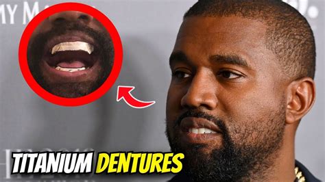 Kanye West Replaces Teeth With Titanium Dentures Worth 850k Youtube