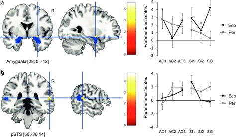 Amygdala And Psts Activity During Ecological And Perceptual Ssu