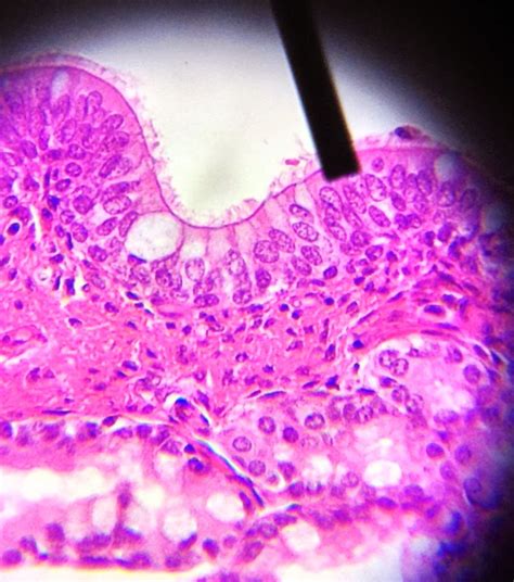 Foto Do Tecido Epitelial De Revestimento Histologia Images And Photos Sexiz Pix