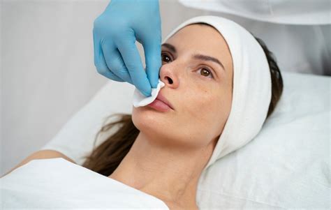 Unveiling Smooth Confidence Upper Lip Laser Hair Removal And Its Benefits Atoallinks
