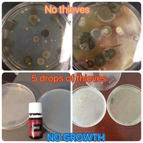 Essential Oils Kill MRSA Bacteria, mold spores and More ...
