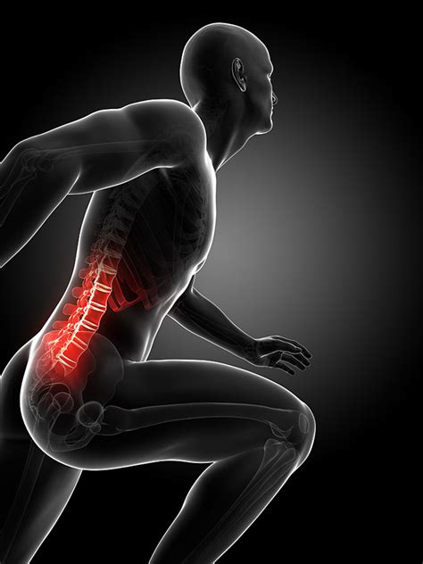 Muscle injuries of the lower back are commonly caused by an improper lift, lifting while twisting, or a sudden movement or fall, which may cause lower to learn more about the anatomy of the spine, watch this video. Lower Back Pain: Treatment, Causes, Types, Symptoms Relief - Physio